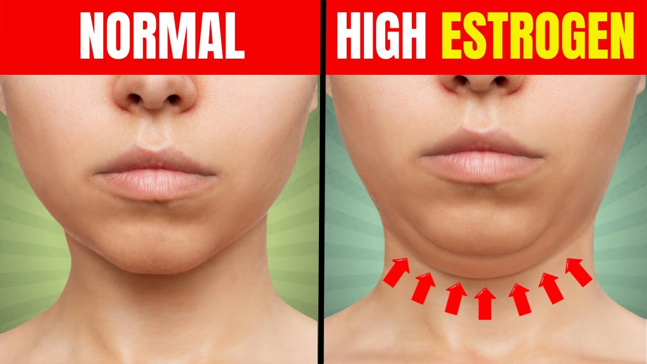 12 Signs You Have High Estrogen Levels In Your Body YouTube