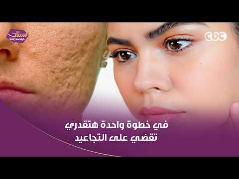 في خطوة واحدة هتقدري تقضي على التجاعيد وتشدي وشك.. اسمعي نصايح دكتور عاصم فرج