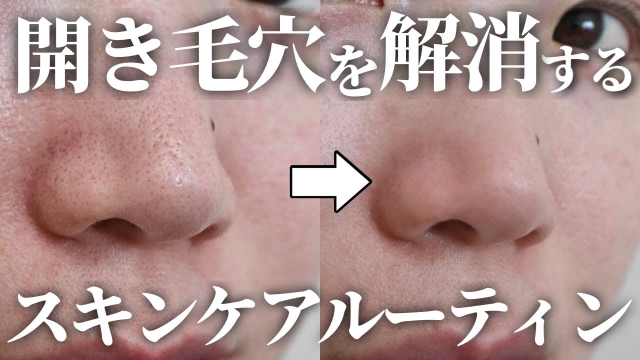 【毛穴に悩む30代必見】開き毛穴を解消して−5歳肌になれる✨スキンケアルーティン【案件なし】