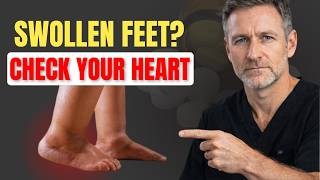 SWOLLEN FEET And Ankles? Your Heart Is Telling You Something
