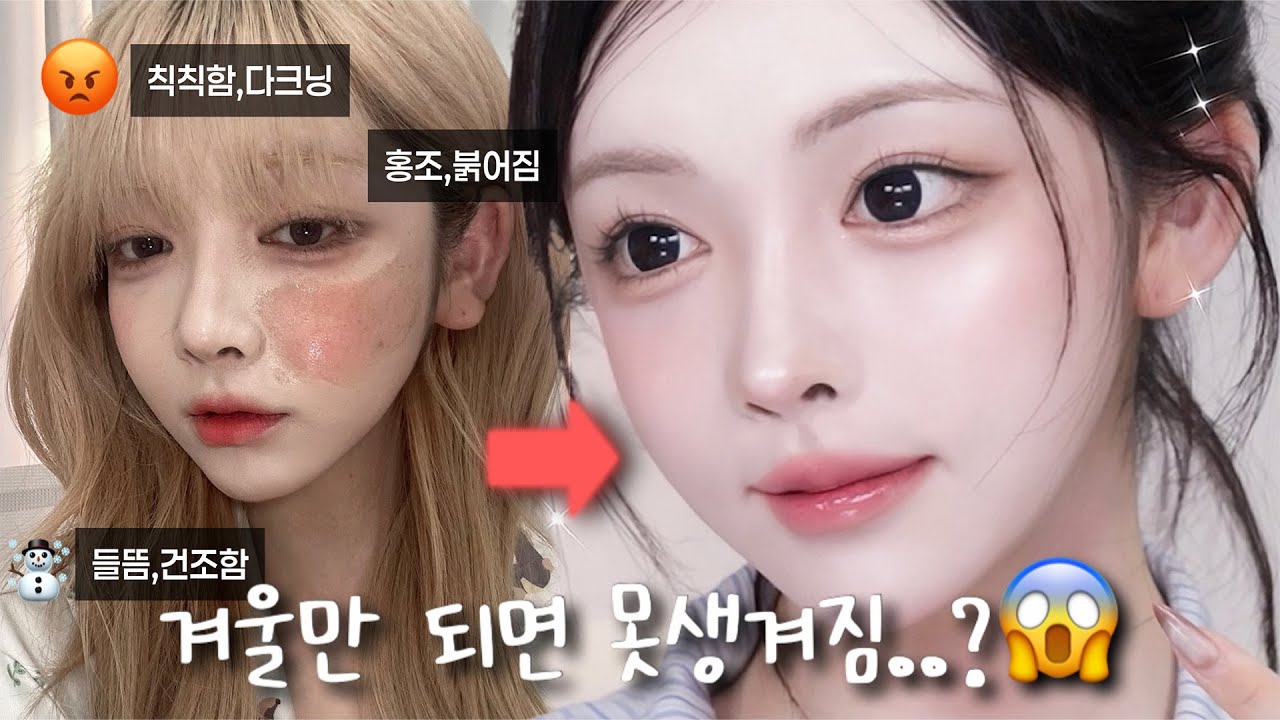 겨울에 갑자기 못생겨보이는 이유?😱 광고❌ 각질·들뜸·건조 해결 루틴 & 추천템까지!