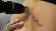 seattle skin u0026 laser youtube seattle skin u0026 laser youtube