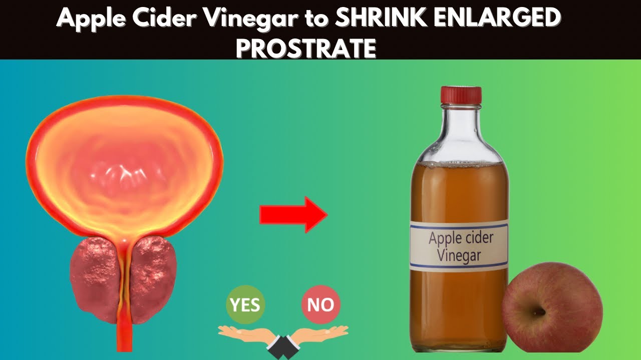 Is Apple Cider Vinegar Good For Enlarged Prostate