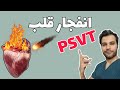 تپش شدید قلب Psvt تاکی کاردی قلبی