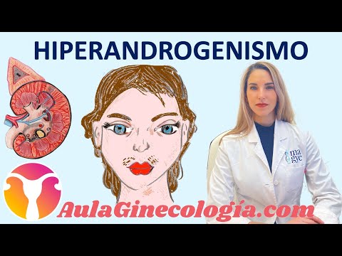 Vídeo: Hiperandrogenismo: Síntomas, Tratamiento, Hiperandrogenismo En Mujeres