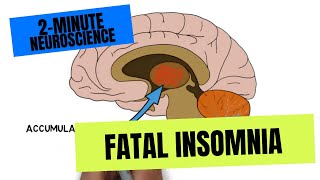 2-Minute Neuroscience: Fatal Insomnia by Neuroscientifically Challenged 40,954 views 1 year ago 1 minute, 59 seconds