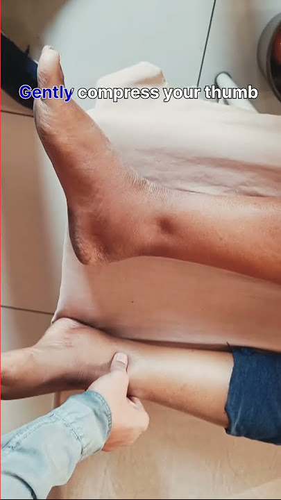 how to check for pedal odema/edema | Leg swelling | #shorts #edema #swelling