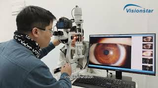 S5D Ophthalmic Digital Slit Lamp Brief Introduction