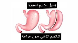 أسهل نظام لإنقاص الوزن/ التكميم الذهني بدون جراحة Amal Hussein Diet?