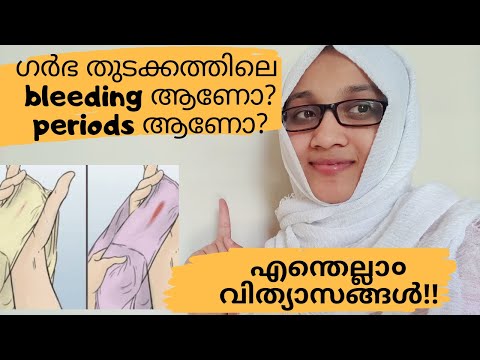 Implantation Bleeding Or Period Bleeding/Malayalam/How To Identify The Difference.