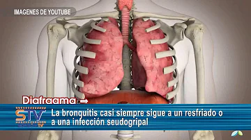 ¿La bronquitis es un resfriado o una gripe?