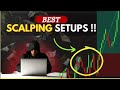 Best Scalping Trading Strategy | Scalping Trading Setups