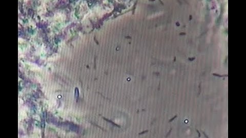 Your mouth could have life threatening bacteria!