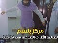 مركز للأطراف الصناعية بحلب هل يكفي وما هي المواصفات 