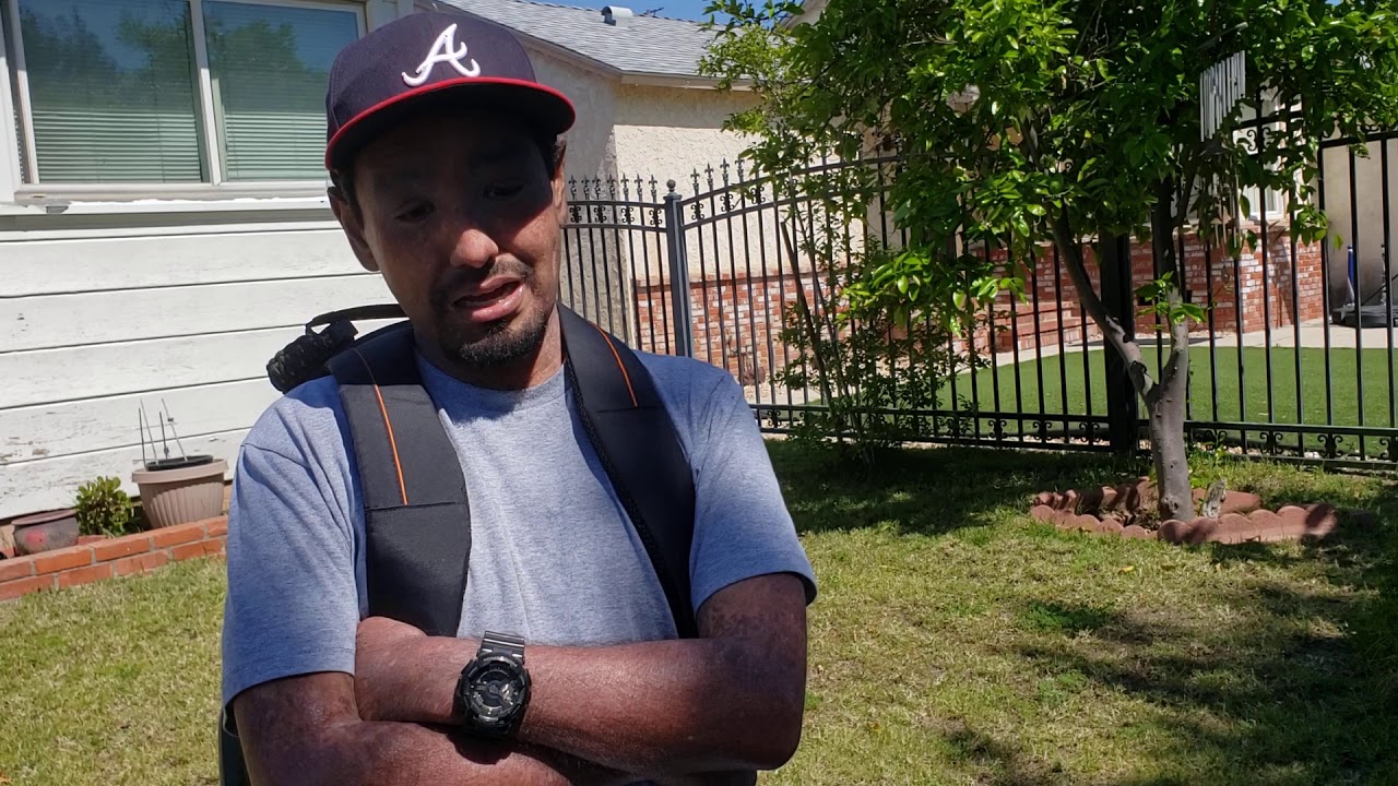 Living with Dermatomyositis