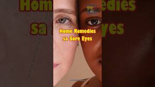 Home Remedies sa Sore Eyes