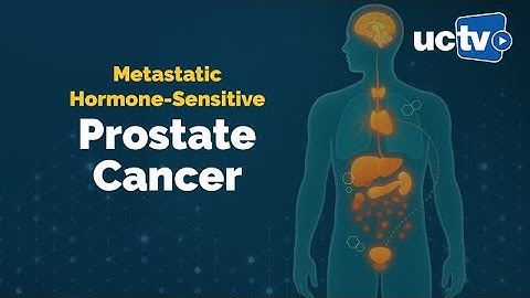 Metastatic Hormone-Sensitive Prostate Cancer