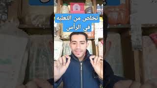 ازاي تتخلص من الثعلبة في فروه الراس بكل سهوله #الثعلبة