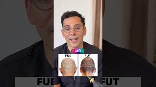 The Real Difference Between Fue And Fut Hair Transplants Doctor Explains