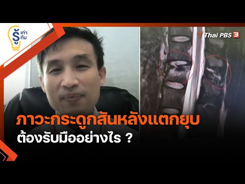 รู้ทัน "ภาวะกระดูกสันหลังแตกยุบ" ต้องรับมืออย่างไร ? : รู้เท่ารู้ทัน