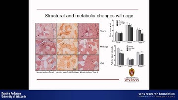 Impact of CR on aging in rhesus monkeys -- a focus on metabolism - Rozalyn Anderson