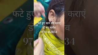 बिना सर्जरी के कान के छेद बंद कराएं | EAR LOBE REPAIR WITHOUT PAIN AT SHRI RAM AUSHDHALYA HOSHIARPUR