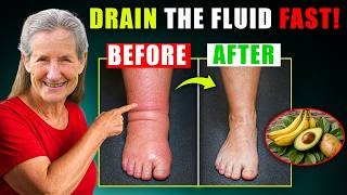 Goodbye Swelling 8 Potassium-Rich Foods That Drain Fluid FAST Barbara O Neill