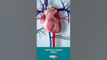 Ventricular Septal Defect Surgery ↪ 3D Medical Animation #Shorts #VSD #VentricularSeptalDefect