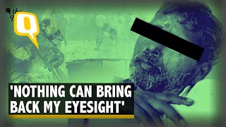 2 Lakh for Damaged Eyes: The Price of Delhi Riot Victims' Loss | The Quint