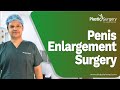 লিঙ্গ স্থায়ীভাবে বড় করার সার্জারি | Penis enlargement surgery | Penis lengthening