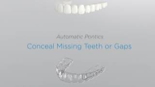 SureSmile Clear Aligner Software 7.2 - Clinician Benefits