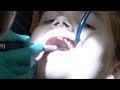 Family dentist vlog  my kids are not scared  who has a cavity 