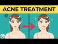 Acne Types and Treatments | Which Drugs Should We Use?