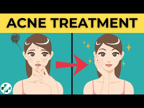 ቪዲዮ: Accutane ላይ ሳሉ ቆዳዎን ለመንከባከብ 4 መንገዶች