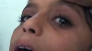 Girl Cries STONES Instead of Tears, Baffles Scientists- Saadiya Saleh
We’ve seen people shedding tears of blood before, but this 12-year-old Yemeni girl’s problem is truly baffling. When Saadiya Saleh cries, her eyes release small, hard stones. They form under her eyelids and get pushed to the front of her eyes, emerging as tears.
Doctors are unable to explain the strange phenomenon because Saadiya isn’t suffering from any known disease. Yemen’s satellite TV channel, Azal, aired a video that shows stones forming in her eyes. She is surrounded by family members and doctors, while a helper wipes her eyes with a napkin. The footage also reveals a small box full of stones that collected from Saadiya’s eyes in a few hours. Girl Cries STONES Instead of Tears, Baffles Scientists- Saadiya Saleh