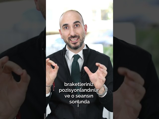 TELLER VE BRAKETLERLE TEDAVİDE İLK SEANSTA NELER YAPILIR? - DR.CANER BALTA #canerbalta #ortodonti