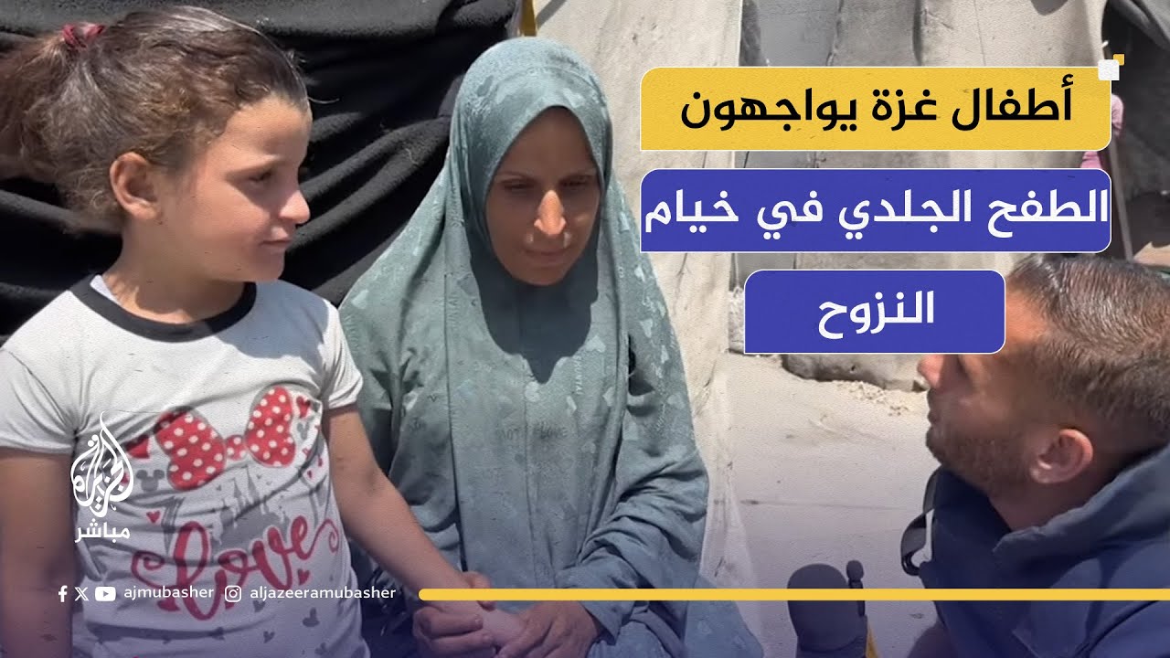 معاناة مستمرة للأطفال جراء انتشار الأمراض الجلدية بين الخيام