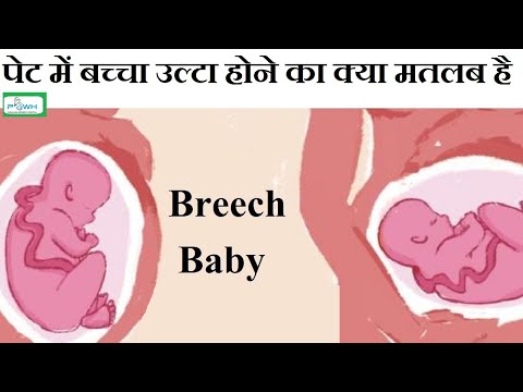 वीडियो: ब्रीच का मतलब क्या होता है?