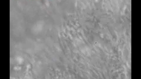 Apical View of Normal Cilia