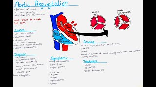 Aortic Regurgitation - Causes, Symptoms, Diagnosis, Treatment, Grading screenshot 4