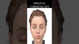 Surgical Forehead Lift #shorts #face