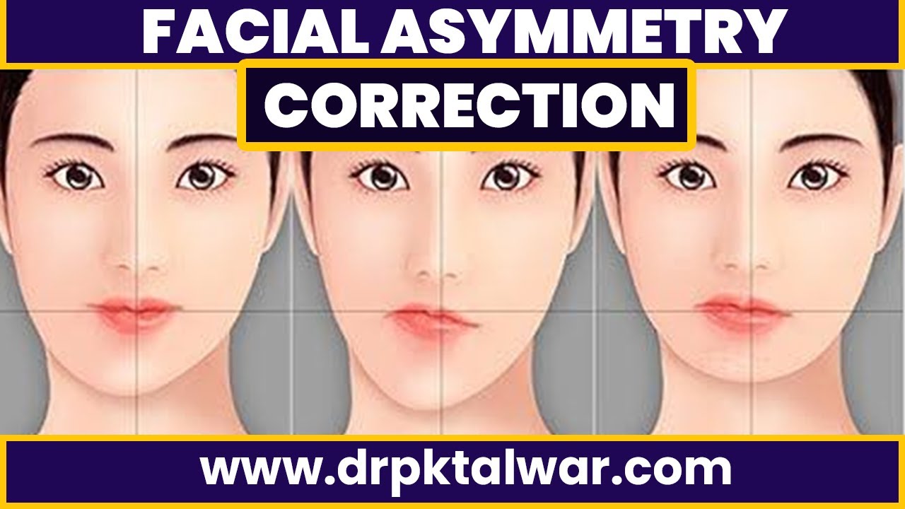 Asymmetrical Face, Fix Facial Symmetry With Fat Injection, Bone Graft And  Implant | Dr Pk Talwar - Youtube