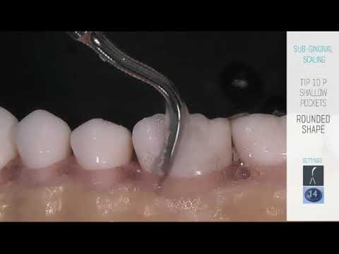 Newtron Scaler Tip No 10P