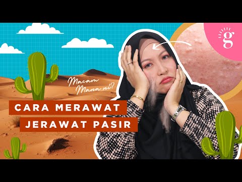 Video: Facials Untuk Jerawat: 6 Jenis, Langkah Umum, Cara DIY, Lebih