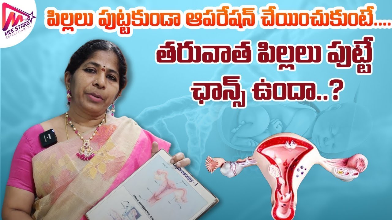 How to Get Pregnancy After Family Planning Operation Recanalization