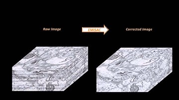 Optimization-Based Artifact Correction for Electron Microscopy Image Stacks