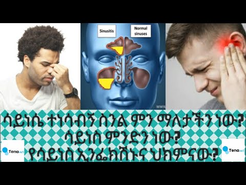 ቪዲዮ: NAT ማሰሪያ ምንድን ነው?