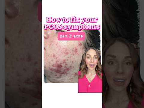 😔 Stubborn ACNE?!