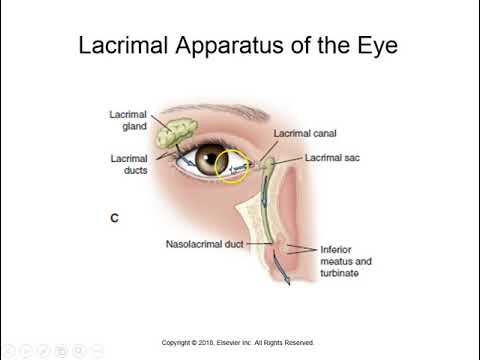 Video: Anisometropia - Glossary Of Medical Terms