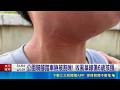 公園騎腳踏車險被割喉! 收風箏線傷6歲孩頸 公園騎腳踏車險被割喉! 收風箏線傷6歲孩頸｜記者 施凱文 曹勝彰｜新聞一把抓20260518｜三立新聞台